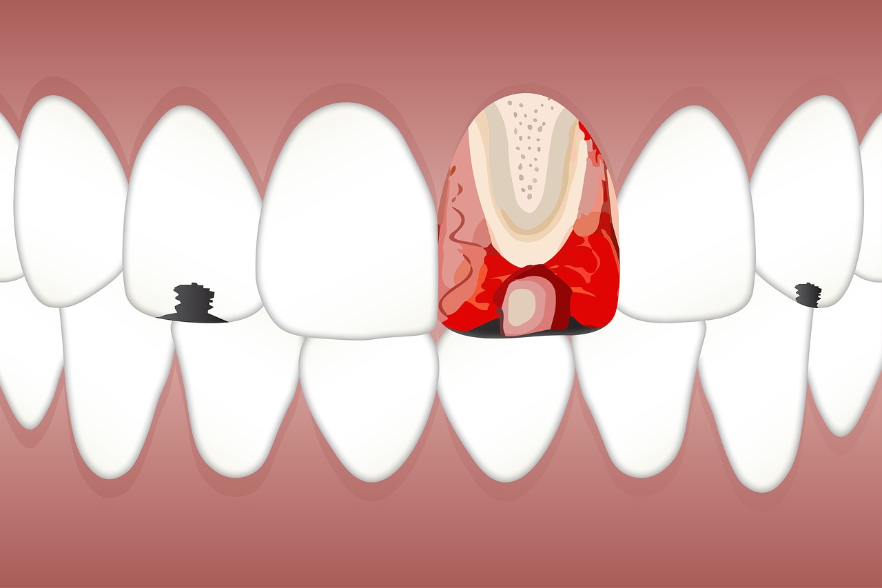 sensivity tooth